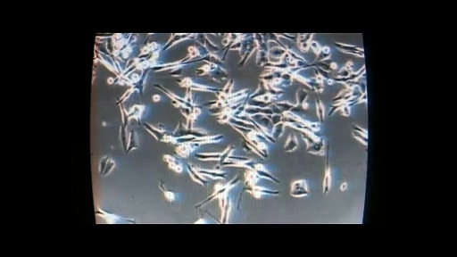 Nécrose | movie | 2024 | Official Trailer