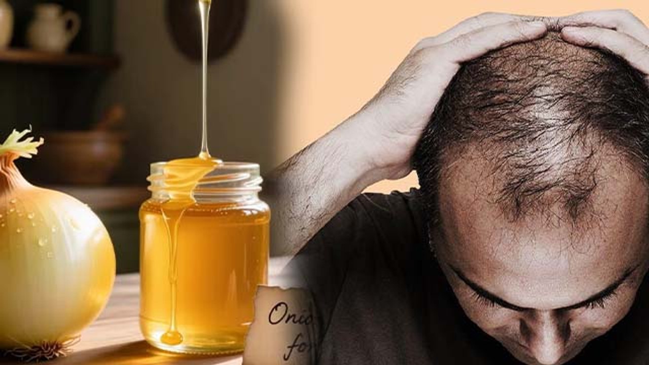 Honey & Onion Benefits: बालों में शहद और प्याज का रस लगाने के जबरदस्त फायदे | Boldsky