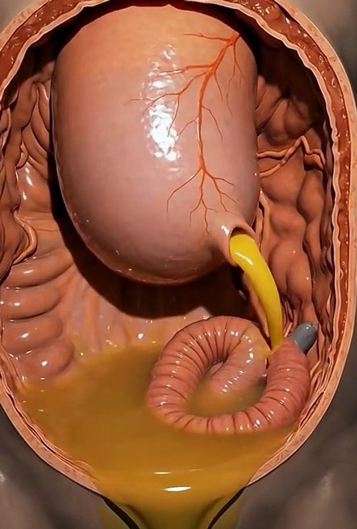 Health