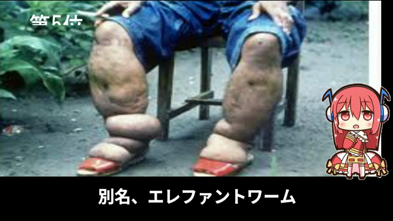 【豆知識】危険な寄生虫　【Trivia News】Dangerous Parasites