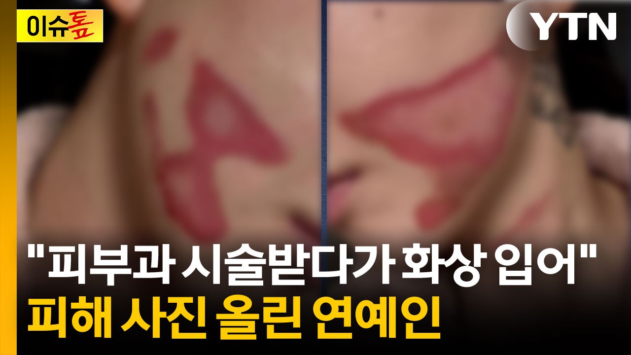 "피부과 시술받다가 2도 화상"...피해 호소한 연예인 [이슈톺] / YTN
