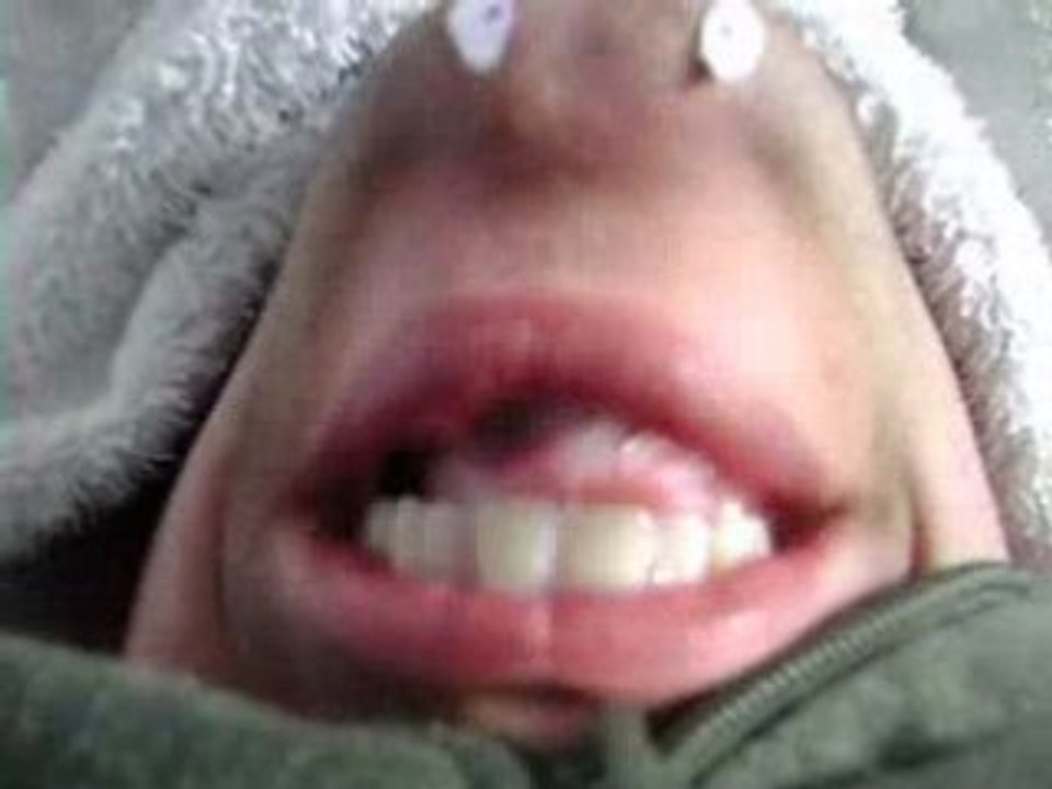 Chin Face