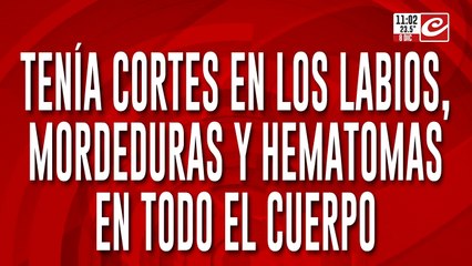 Dramático relato de la hermana de la nena de siete años torturada por su padrastro