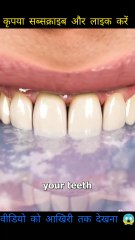 Can hot coffee ☕ crack frozen ❄️teeth ? #factsort #facts #3Dfacts