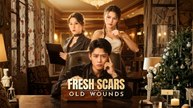 Fresh Scars, Old Wounds