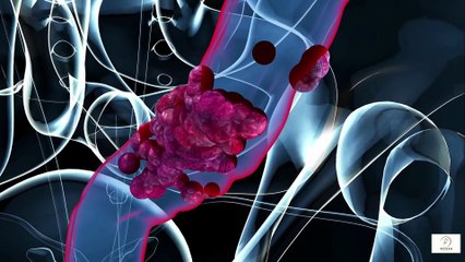 ⭐ “New Options for Colon Cancer in People Over 60 Gentler, Smarter & More Effective Than Ever”