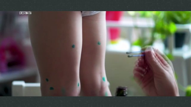 Confirman primer caso de sarampión en Valle Dorado | CPS Noticias