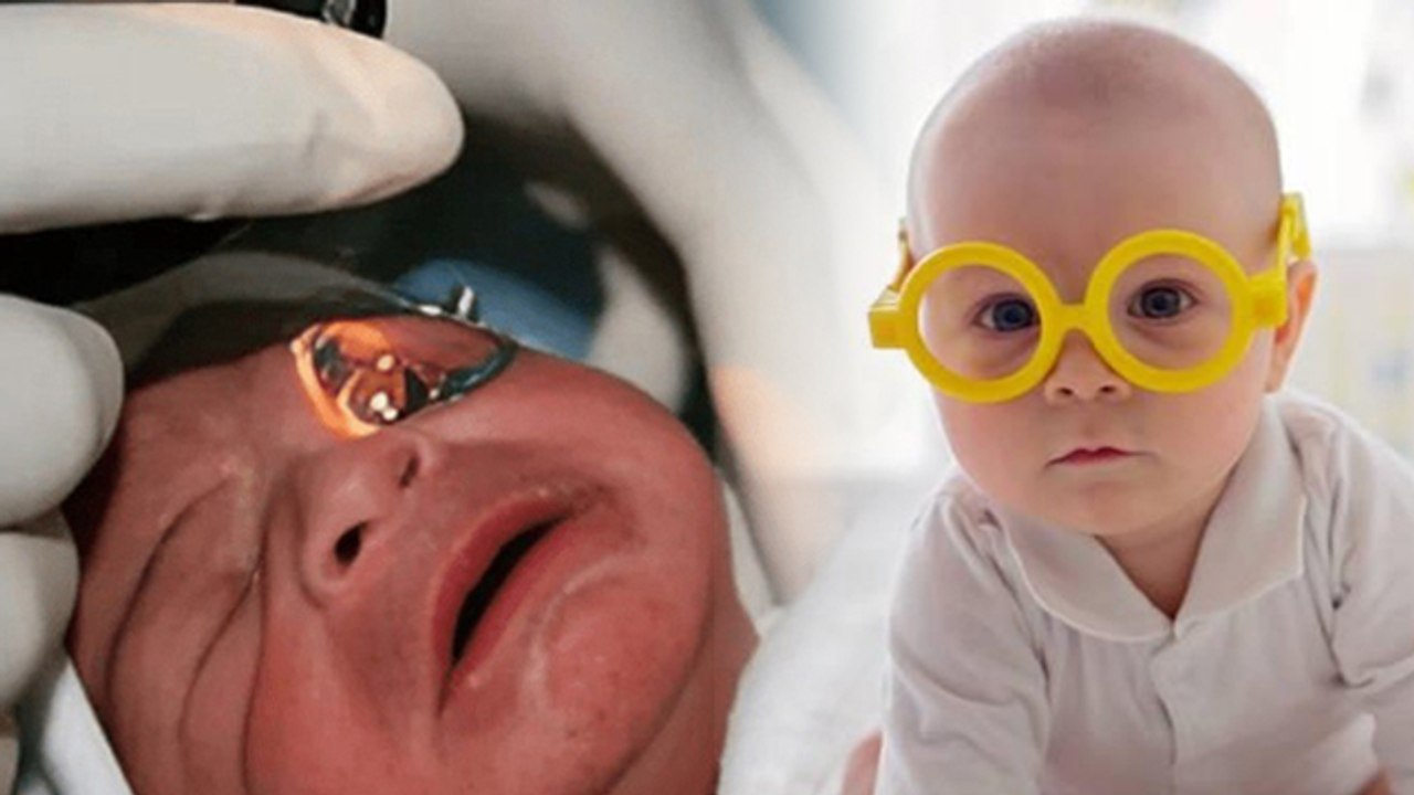 Genetic Eye Problems In Babies:बच्चों को चश्मा क्यों लग जाता है,कारण और लक्षण|Congenital Eye Disease