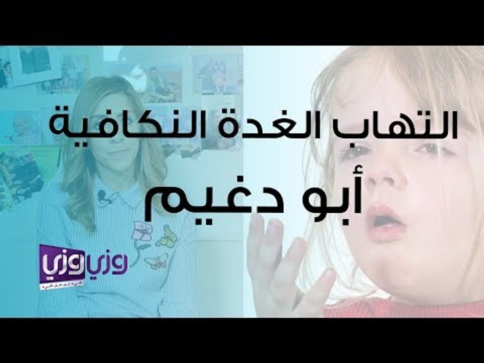 التهاب الغدة النكافية – أبو دغيم