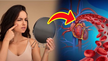 Sardiyo Me Skin Kali Kyu Ho Jati Hai, सर्दियों में स्किन काली क्यों होती है | Treatment In Hindi....