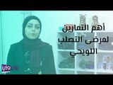 أهم التمارين لمرضى التصلب اللويحي