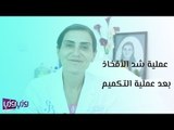 عملية شد الأفخاذ بعد عملية التكميم