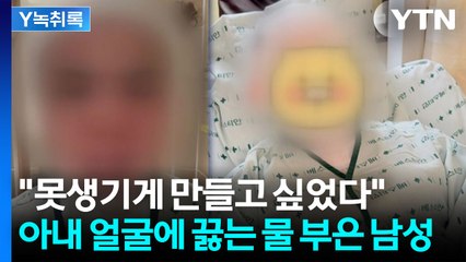 태국인 아내 얼굴에 끓는 물 부은 남성...경악한 대사관도 긴급 조치 [Y녹취록] / YTN
