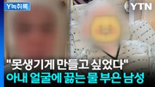 태국인 아내 얼굴에 끓는 물 부은 남성...경악한 대사관도 긴급 조치 [Y녹취록] / YTN