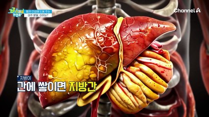 혈당 관리에 도움되는 이것! 여주 분말이 체중 조절에 도움되는 이유