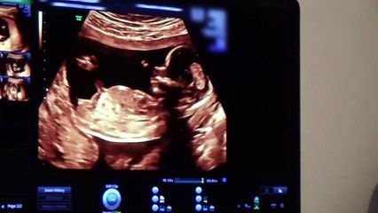 Kylie Jenner Gives Birth In Emotional Video For Fans