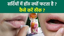 Chapped Lips Reason:सर्दियों में होंठ क्यों फटता है , Sardiyo Me Hoth Fat Jaye To Kya Kare | Boldsky
