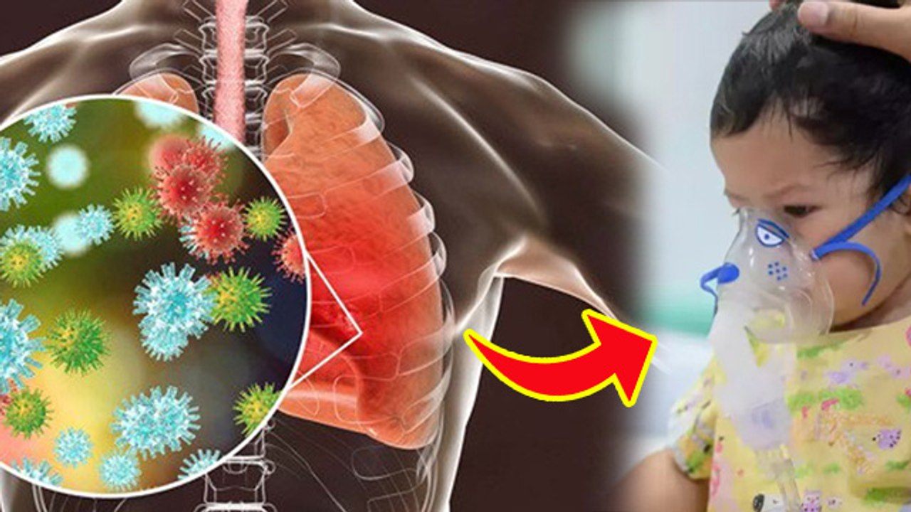 RSV Virus Symptoms: क्या होता है RSV Virus, बच्चों में RSV वायरस के लक्षण और कारण क्या हैं | Boldsky