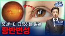 [메디컬 인사이트 114회] 중년부터 급증하는 '황반변성의 증상과 치료법' / YTN