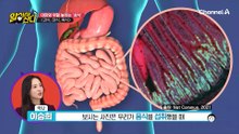 대장 건강을 망치는 식사 '삼식' 과식, 야식, 폭식