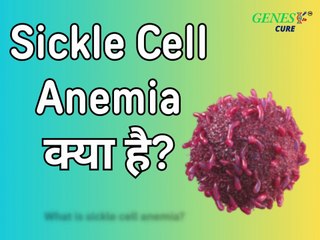 What Is Sickle Cell Anemia?