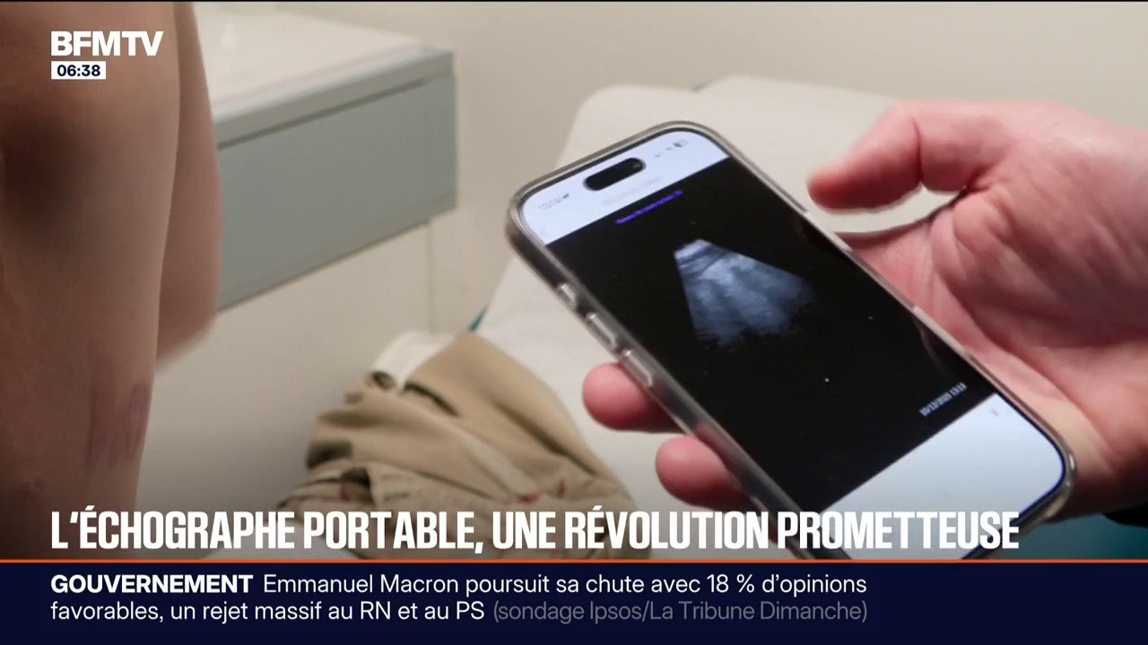 Une sonde d'échographie portable pour désengorger les services de radiologie