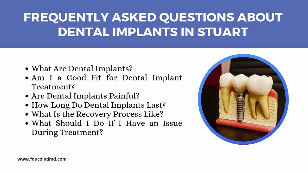 Common Questions About Dental Implants in Stuart