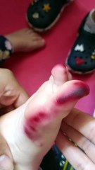 Mãe de Umuarama alerta para riscos de acidentes com piolho-de-cobra após chuvas intensas