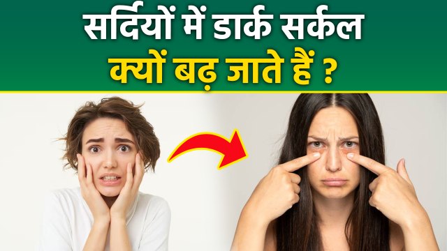 Dark Circles In Winter Season: Sardiyon Mein Aankhon Ke Niche Dark Circle Hone Ka Kya Karan Hai?