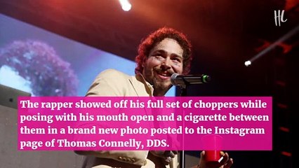 Post Malone Spends $1.6 Million On New Smile With Diamond Vampire Fangs