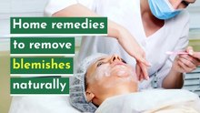 Home remedies to remove blemishes naturally