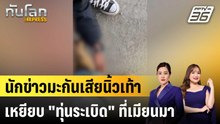 นักข่าวอเมริกันเหยียบ "ทุ่นระเบิด" ในเมียนมา |ทันโลก EXPRESS | 18 ธ.ค. 68
