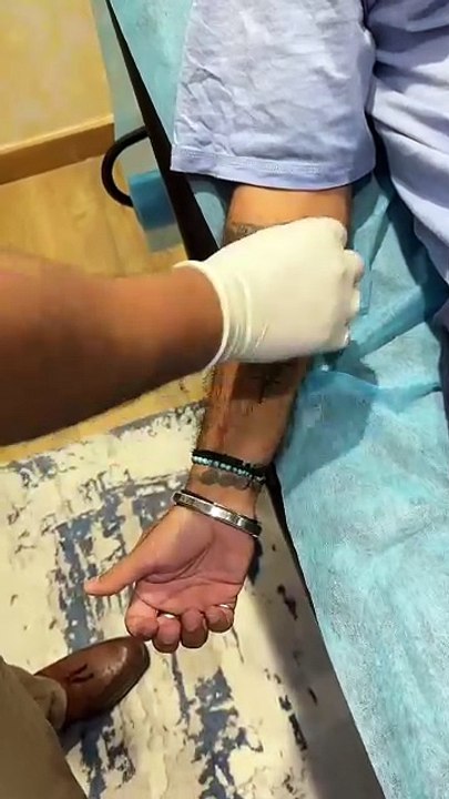 Skin Gems: The Art of the Dermal Piercing #dermalpiercing #microdermalpiercing #surface #piercings