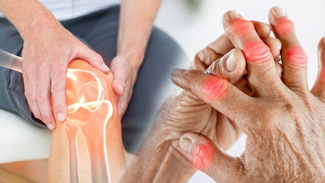 Rheumatoid Arthritis Pain : सर्दियों में रूमेटॉइड आर्थराइटिस का दर्द क्यों बढ़ जाता है,कैसे ठीक करें?