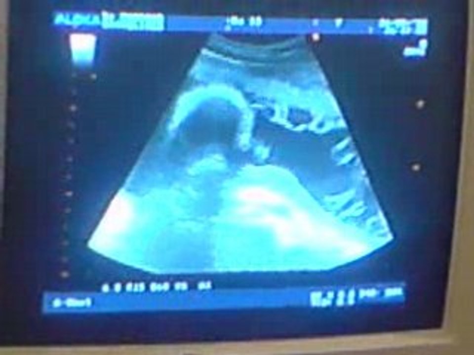echographie 27SA