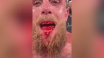 Así quedó el rostro de Jake Paul tras el KO de Anthony Joshua
