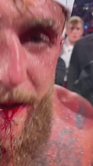 Así quedó el rostro de Jake Paul tras el KO de Anthony Joshua