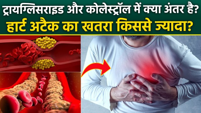 Cholesterol Vs Triglycerides: ट्रायग्लिसराइड और कोलेस्ट्रॉल में हार्ट अटैक का खतरा किससे ज्यादा है?