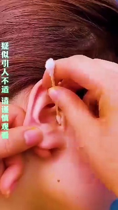 Stop using the old-fashioned ear picks. Replace them with this one