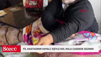300 kilo alan adam 5 yıldır evden çıkamıyor! Hayali eşiyle kol kola gezmek