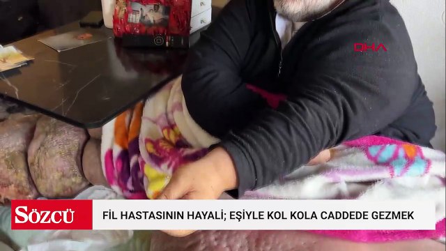 300 kilo alan adam 5 yıldır evden çıkamıyor! Hayali eşiyle kol kola gezmek