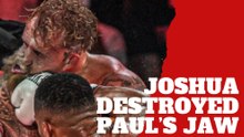 Jake Paul shows how Anthony Joshua completely destroyed his jaw