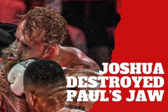 Jake Paul shows how Anthony Joshua completely destroyed his jaw
