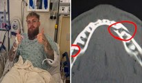 Jake Paul sale de cirugía mandíbula tras pelea con Anthony Joshua