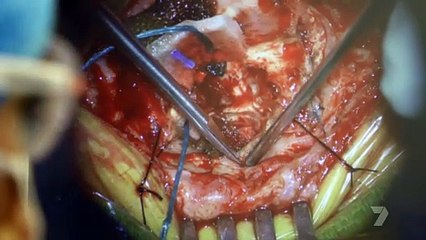 nurses au s01e04 internal