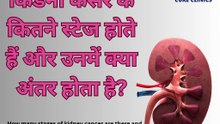 How Many Stages Are There in Kidney Cancer and What Is the Difference Between Them?