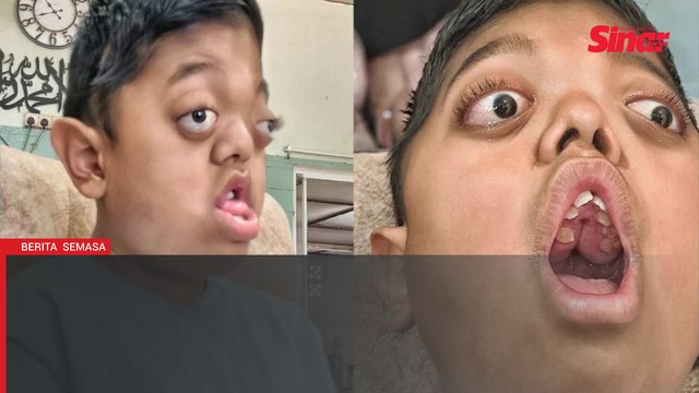 Muhammad Niyaz perlu dana lebih RM34,000 untuk pembedahan