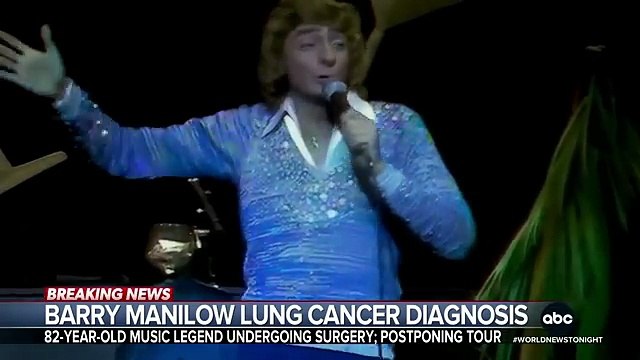 Le chanteur et compositeur américain Barry Manilow, 82 ans, interprète notamment de succès comme Copacabana ou Mandy , annonce souffrir d'un cancer du poumon