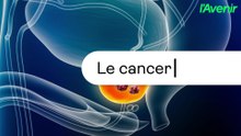 Santé/le cancer de la prostate