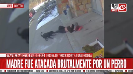 Madre fue atacada brutalmente por un perro y debió ser internada